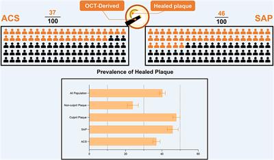 Prevalence of Healed Plaque and Factors Influencing Its Characteristics Under Optical Coherence Tomography in Patients With Coronary Artery Disease: A Systematic Review, Meta-Analysis, and Meta-Regression